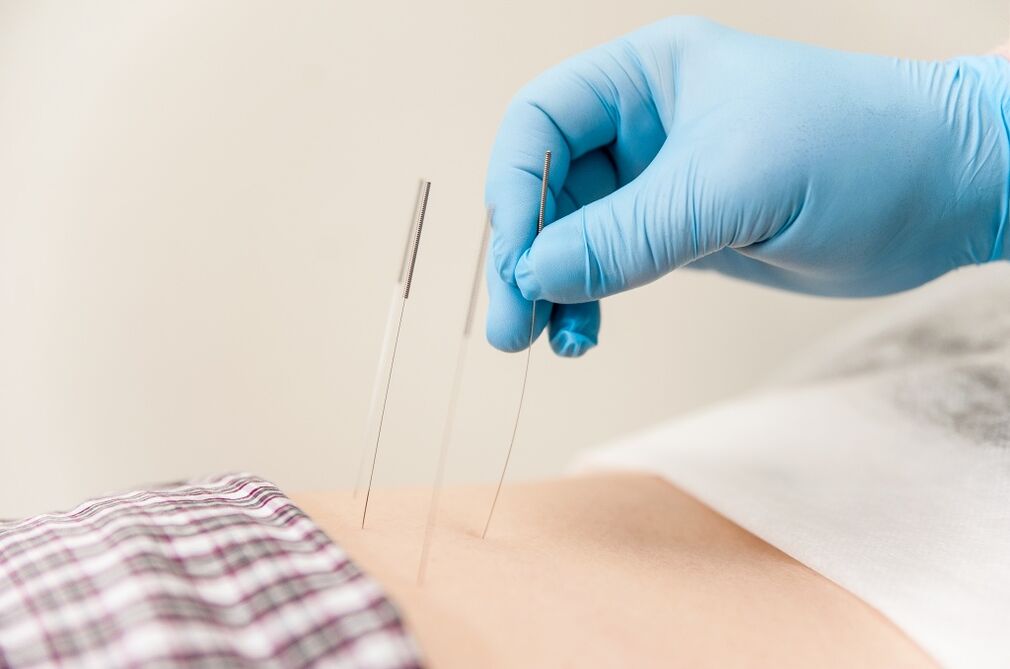 Zdravljenje s torakalno osteohondrozo