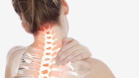 Osteohondroza vratne hrbtenice