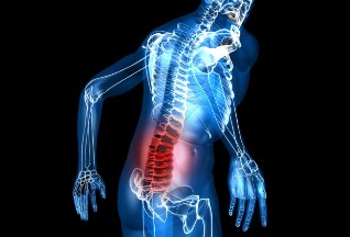 kaj je osteohondroza ledvene hrbtenice